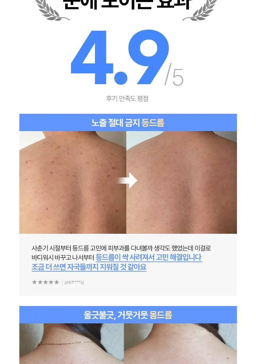 [여드름 기능성]씨드비 이슬로 생분해 아크네 바디워시 500ml 상세페이지 3